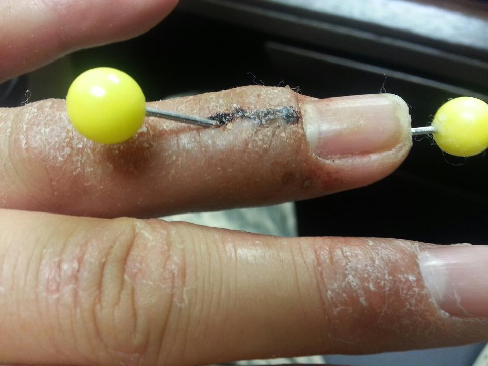finger.jpg